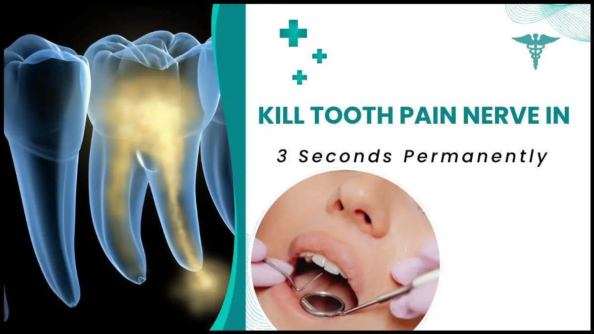 kill-tooth-pain-nerve-in-three-seconds-permanently.webp
